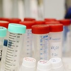 В Исландии зарегистрирован случай заражения двумя штаммами вируса COVID-19 