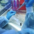 ВОЗ остановила расследование о происхождении Covid-19