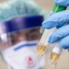 В Казахстане за сутки выявлено 1 069 случаев коронавируса и 798 случаев пневмонии