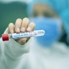 За сутки в Казахстане выявили 1 414 случаев COVID-19