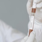 Отменен обязательный ПЦР-тест для вакцинированных казахстанцев