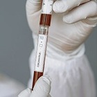 Коронавирусом в Казахстане заразились 652 медицинских работника 