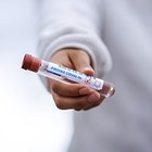 Три миллиона человек в мире заразились коронавирусной инфекцией 