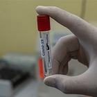 За сутки в Казахстане зарегистрировали 1 430 случаев коронавируса
