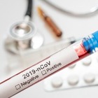 В Казахстане за сутки выявлено 476 случаев COVID-19