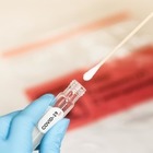 За сутки коронавирусом заразились 263 казахстанца — Минздрав 