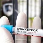 ВОЗ выбрала новое название для оспы обезьян
