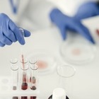 Казахстанские ученые разработали доступный биоматериал для восстановления костей

