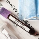 В Казахстане за сутки зарегистрировано свыше 1,3 тысячи новых случаев COVID-19
