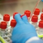 Қазақстанда коронавирусты жұқтырғандардың көбі 30-35 жас категориясына кіреді