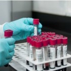 Ученые создали коктейль из антител, который поможет при борьбе с Covid-19 
