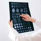 У необщительных людей выше риск столкнуться с деменцией
