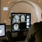 Ученые впервые записали активность умирающего мозга человека