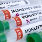 В США оспу обезьян объявили чрезвычайной ситуацией в здравоохранении
