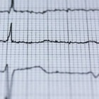 Обнаружена связь между личностными качествами и риском смерти